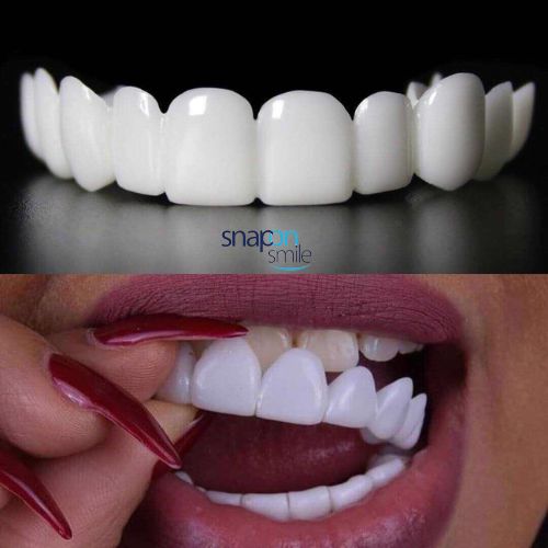 CARILLAS DENTALES - DISEÑO DE SONRRISA EN MINUTOS