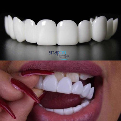 CARILLAS DENTALES - DISEÑO DE SONRRISA EN MINUTOS