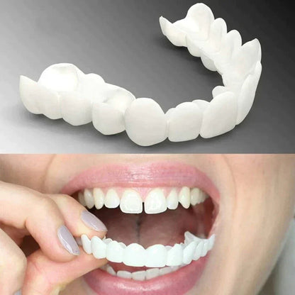 CARILLAS DENTALES - DISEÑO DE SONRRISA EN MINUTOS