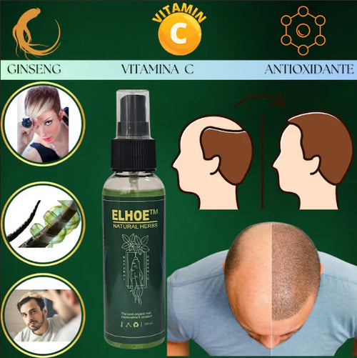 ELHOE TÓNICO PARA CRECIMIENTO DEL CABELLO